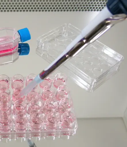 [MO-T40015G] mAb anti- human carbohydrate antigen 19-9 (CA 19-9) ,7E6