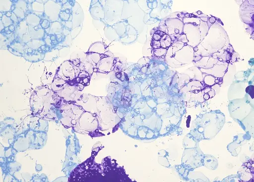 Structural Characteristics of Macrophages